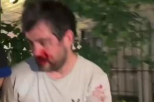 被打到退出刺籍！“邓肯”惨遭纽约暴徒围殴！血流满面脱球衣保命